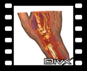Hand - DivX: Context-Preserving Volume Rendering of a human hand